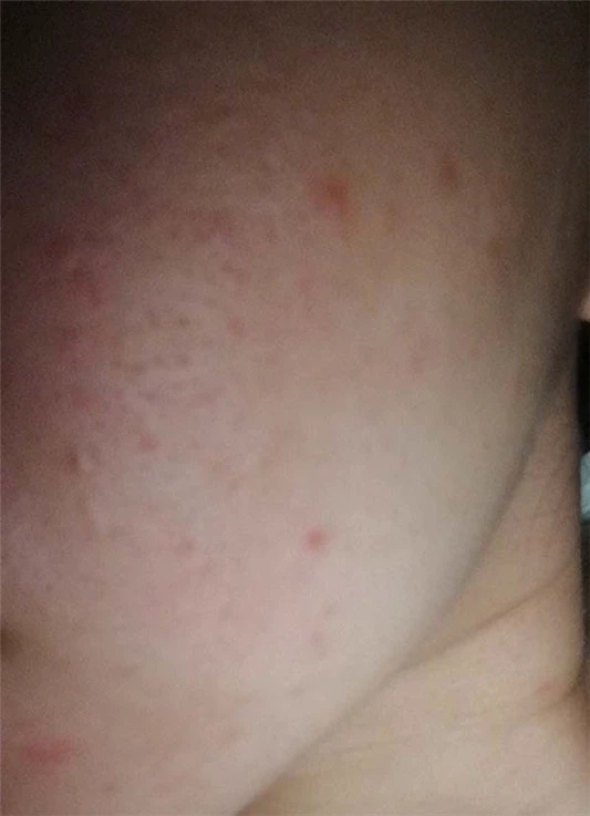 薇诺娜舒敏保湿修红霜适合什么肤质，薇诺娜舒敏保湿修红霜使用评测 薇诺娜 面霜 第6张