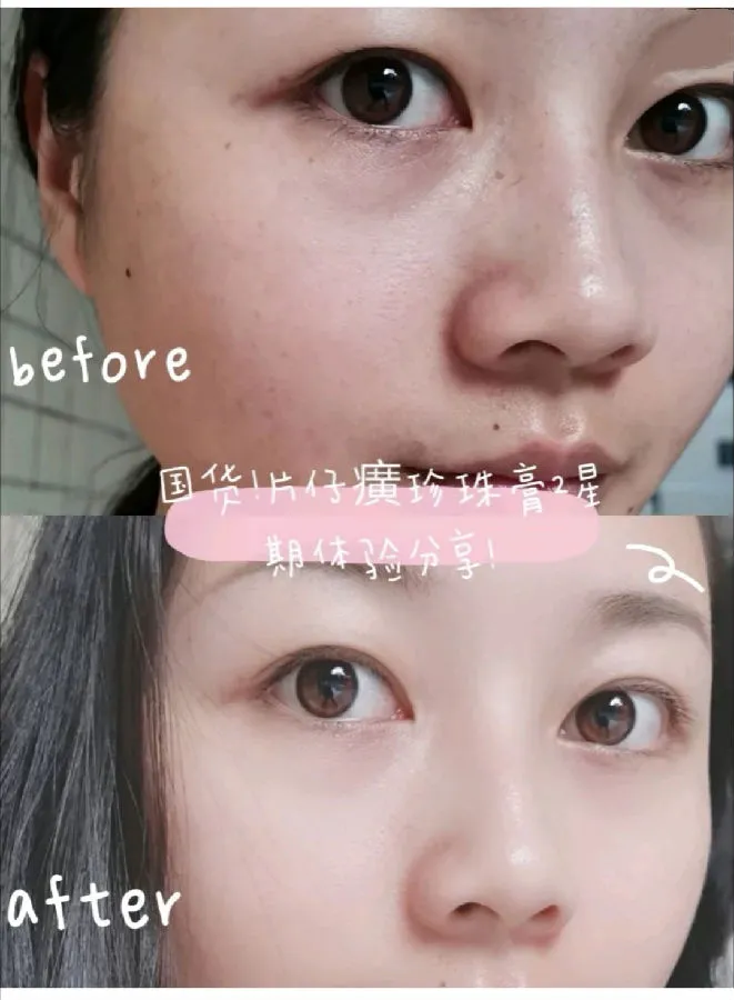 美容达人必看，皇后片仔癀珍珠膏「白金级臻养」的妙用 片仔癀 片仔癀珍珠膏 美容 第4张