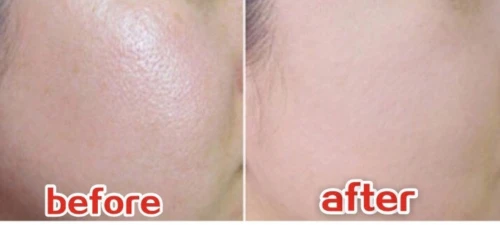 水油失衡皮肤超容易长痘,试试网红爆款波兰苹果面膜油皮也不油腻 面膜 油痘敏感肌 波兰苹果面膜 护肤 第3张 水油失衡皮肤超容易长痘,试试网红爆款波兰苹果面膜油皮也不油腻 面膜 油痘敏感肌 波兰苹果面膜 护肤 第3张