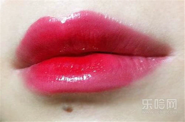 漂唇增生怎么处理 护肤 第2张