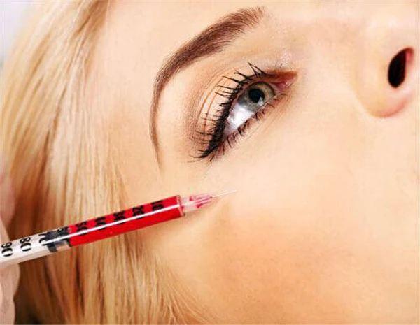 玻尿酸还是胶原蛋白好，打胶原蛋白好还是玻尿酸好 护肤 第4张