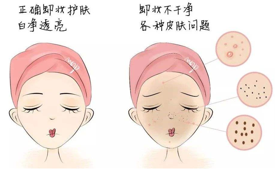 晚上睡觉不卸妆会怎么样,这个毁肤行为你中玩了 卸妆 晚上睡觉不卸妆 晚上睡觉不卸妆有哪些危害 美妆 第1张 晚上睡觉不卸妆会怎么样,这个毁肤行为你中玩了 卸妆 晚上睡觉不卸妆 晚上睡觉不卸妆有哪些危害 美妆 第1张