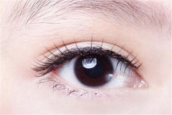 预防女人眼皮下垂的方法：避免浓妆、远离辐射等 女人 眼皮 第1张