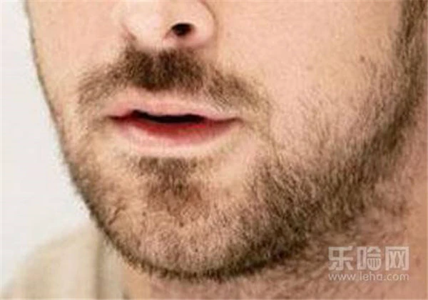 胡子怎么永久去掉 护肤 第4张 胡子怎么永久去掉 护肤 第4张