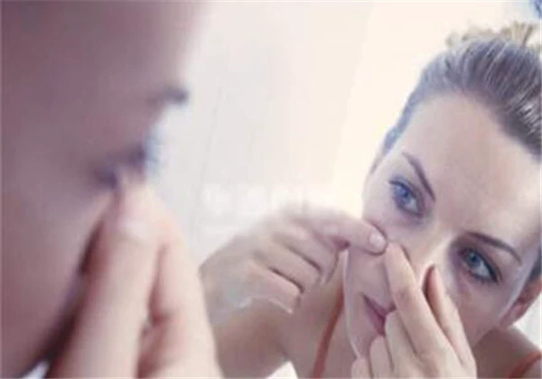 挤痘痘挤出来的是什么 护肤 第4张