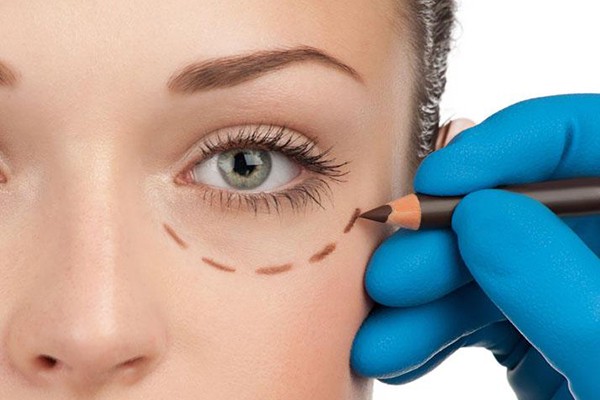 远离下眼袋松弛的方法 眼袋 第1张