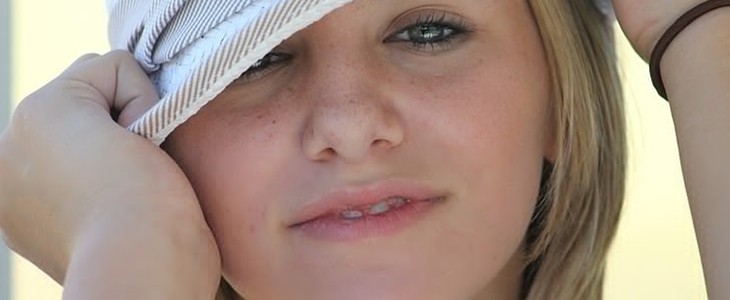 咬肌太大怎么办 咬肌大 美妆 第2张