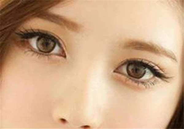 开眼角后注意事项 护肤 第4张