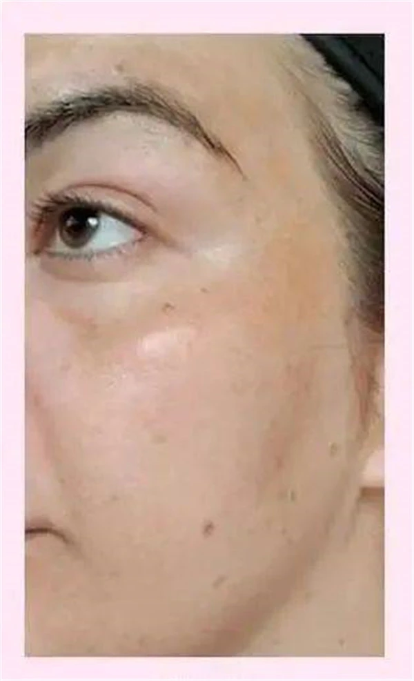 什么是大麻护肤，CBD解锁全新护肤方式 护肤 CBD 第23张