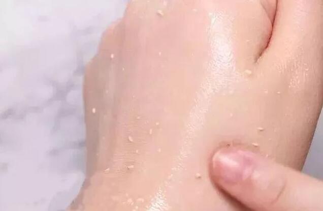 防晒霜出现搓泥现象是怎么回事 防晒霜 防晒霜出现搓泥现象怎么办 美容 第1张