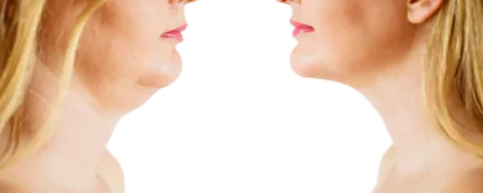 怎么才能减双下巴 减双下巴 美妆 第2张