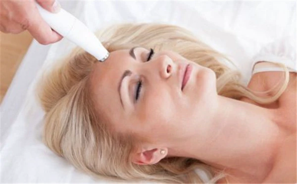 激光祛斑要多长时间，激光去色素斑诊治功夫比较短 激光 祛斑 第2张