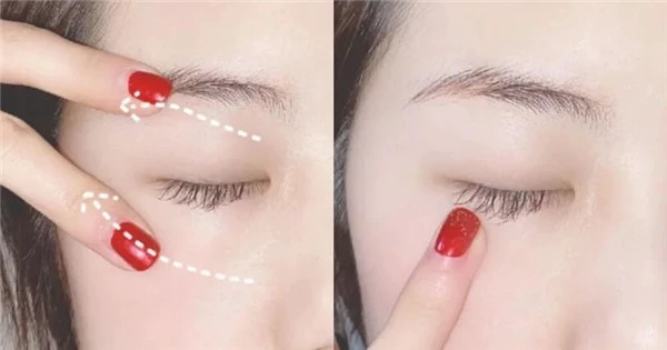 有严重泪沟的人如何改善，泪沟的形成原因都有哪些 泪沟 原因 第4张