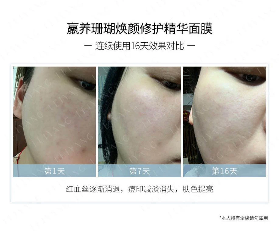 国货面膜也靠谱，最新羸养测评探真知！ 面膜 国货面膜 羸养测评 护肤 第2张