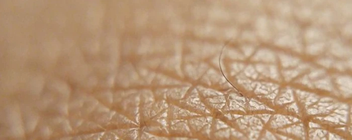 怎么去痘最有效 去痘 美妆 第2张