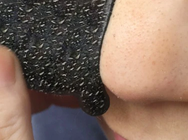 苏打粉能去黑头是真的吗 黑头 苏打粉去黑头 美妆 第3张 苏打粉能去黑头是真的吗 黑头 苏打粉去黑头 美妆 第3张