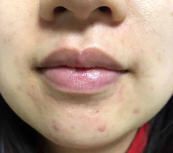 理肤泉k乳怎么样，理肤泉k乳使用测评 理肤泉 k乳 第5张