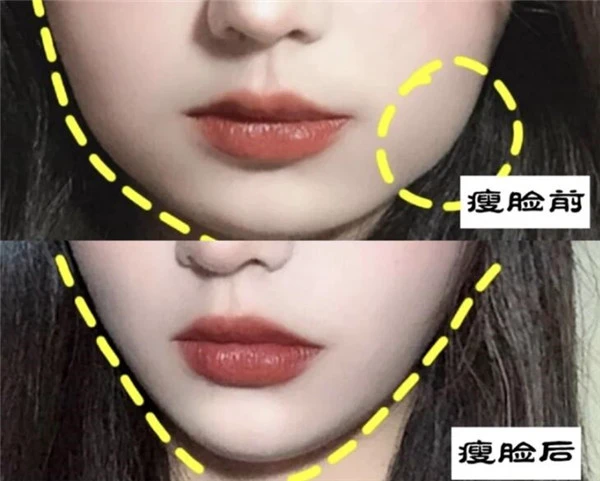超简单瘦脸操搭配瘦身减脂效果会更好，水肿脸少吃重口味食物 瘦脸操 减脂 第3张
