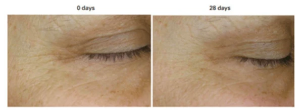 丸美小红笔眼霜便宜又耐用,丸美眼霜不输贵妇眼霜 丸美 眼霜 第15张 丸美小红笔眼霜便宜又耐用,丸美眼霜不输贵妇眼霜 丸美 眼霜 第15张