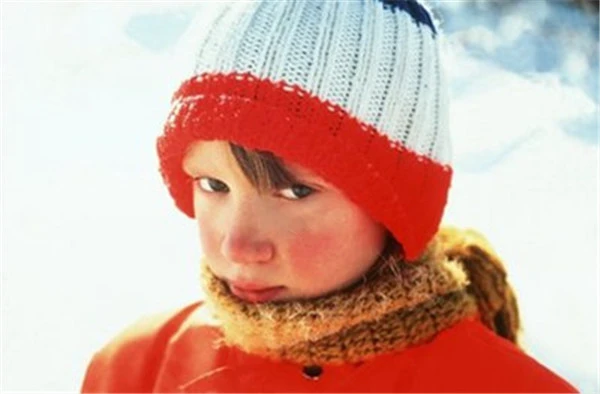 脸上红血丝一般后天形成，血液循环受阻引起等 脸上 红血丝 第3张