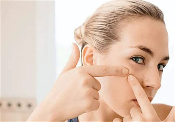 吃辣椒长痘痘怎么消除，吃辣椒长痘痘不用怕，这样祛痘再辣也敢吃！ 护肤 第7张