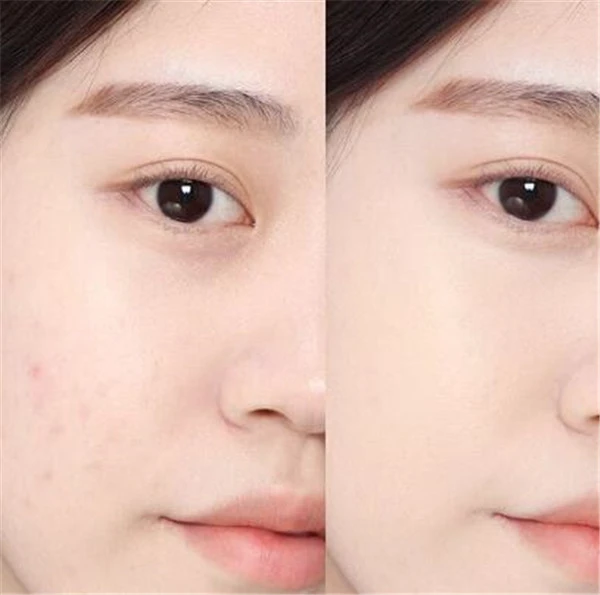 痘痘肌选择遮瑕的技巧,与肤色同色调或暗一色阶行么 痘痘肌 遮瑕 第4张 痘痘肌选择遮瑕的技巧,与肤色同色调或暗一色阶行么 痘痘肌 遮瑕 第4张