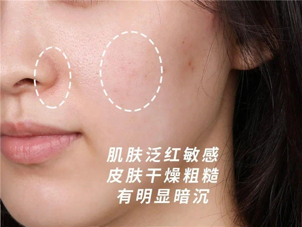 LA，MER酸橙茶精萃强韧肌肤，打造医美效果 酸橙茶精萃 LA MER 第10张