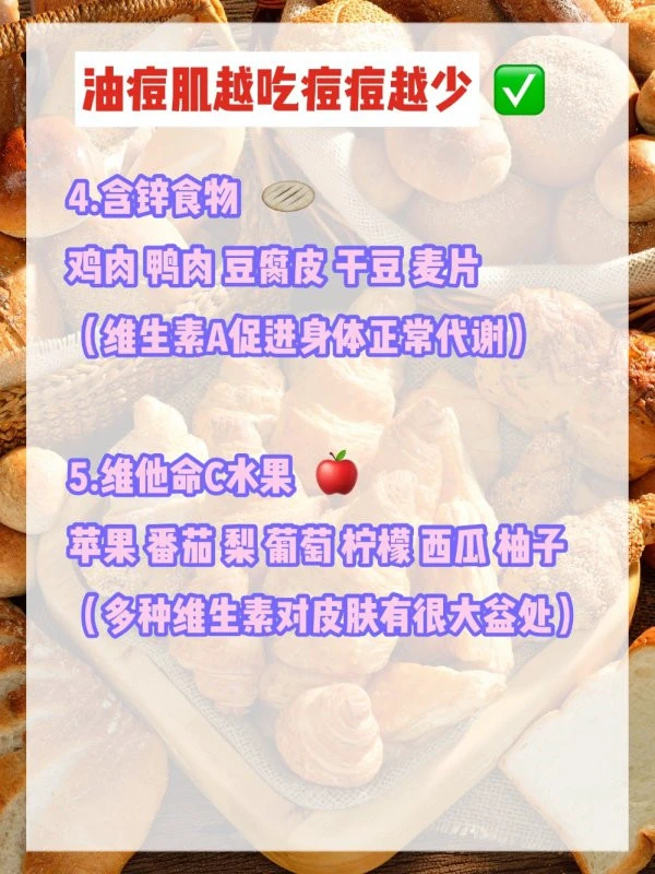 油痘肌忌油腻食物咖啡，海蟹带鱼容易加重痘痘 油痘肌 痘痘 第5张
