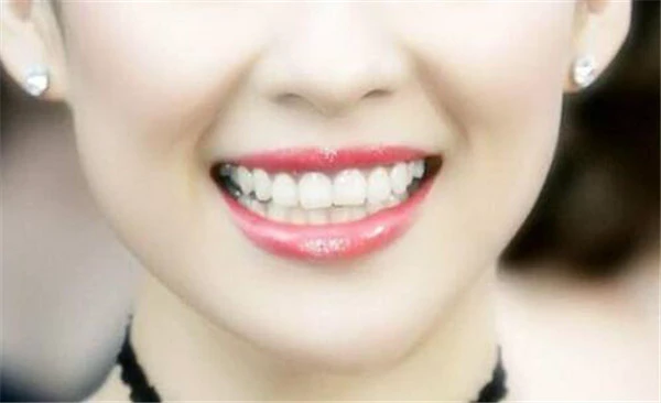 冷光美白牙齿后酸疼怎么回事 护肤 第3张