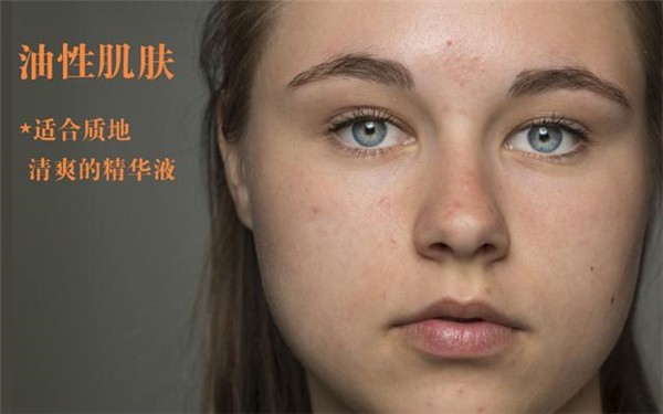 油性肌肤适合哪款精华液，不含油脂的精华液不含油脂的精华液 油性肌肤 精华液 第1张