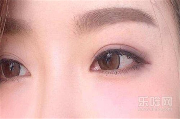 埋线双眼皮是怎么弄的 护肤 第1张
