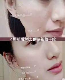 警惕肌肤衰老发出的信号，「小弹簧」凝时精华快快备起来 片仔癀 小弹簧 抗衰老护肤品 美妆 第3张