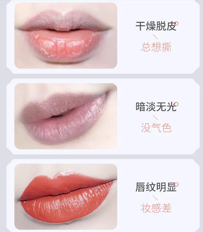 唇色深怎么办,盘点淡化深唇色有效方法 唇色 改变唇色深 改变唇色深有效方法盘点 美妆 第3张 唇色深怎么办,盘点淡化深唇色有效方法 唇色 改变唇色深 改变唇色深有效方法盘点 美妆 第3张