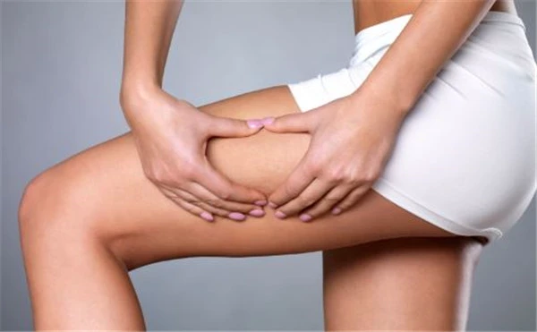 腿部吸脂怎么样，快速瘦腿的方法有哪些 腿部 吸脂 第3张