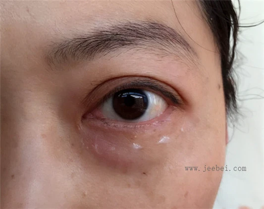 丸美弹力蛋白日夜眼精华使用测评 丸美 精华 第5张