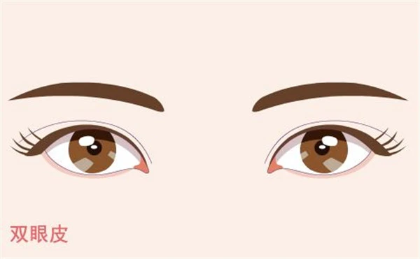 选择割双眼皮方案，只想去除脂肪的眼睛 双眼皮 方案 第2张
