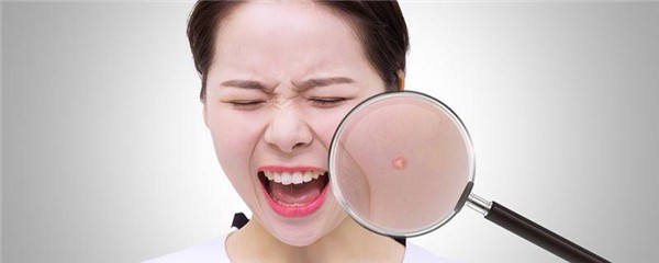 为什么脸越补水越油，补水皮肤变油性是什么原因 护肤 第1张