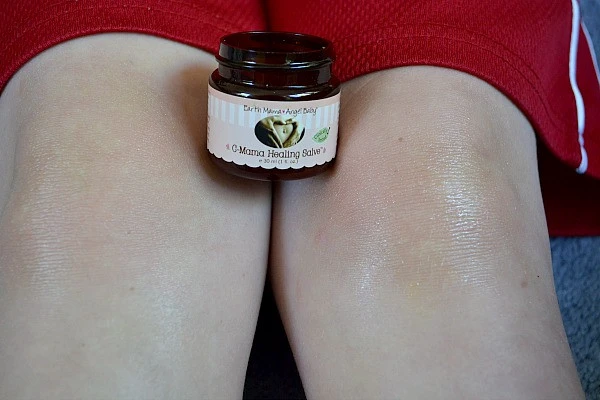 有了疤痕怎么办，有没有治疗疤痕的好办法 疤痕 第2张