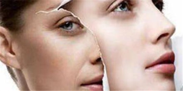 红枣泥敷面伸展皱纹，猪蹄膏去皱效果明显 红枣泥 猪蹄膏 第1张