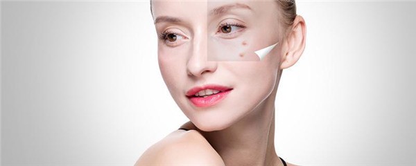有皱纹应该怎么办，去皱纹有什么注意事项 护肤 第1张