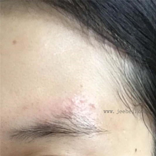 薇诺娜舒敏保湿修护精华液使用评测 薇诺娜 精华 第7张