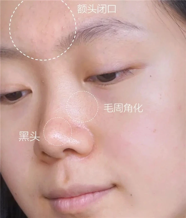 护肤的七大步骤,护肤误区要牢记 护肤 第6张 护肤的七大步骤,护肤误区要牢记 护肤 第6张