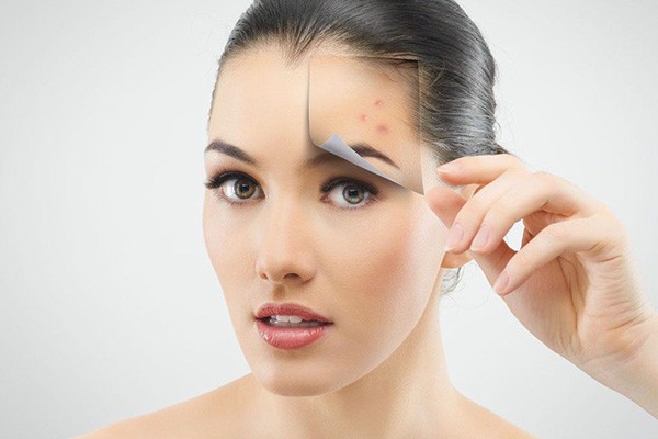 长了闭口粉刺怎么办，闭口粉刺怎么去除 粉刺 第1张