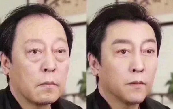 不手术就可去除眼袋的方法，隔夜茶热敷眼部或贴眼贴 眼袋 方法 第2张