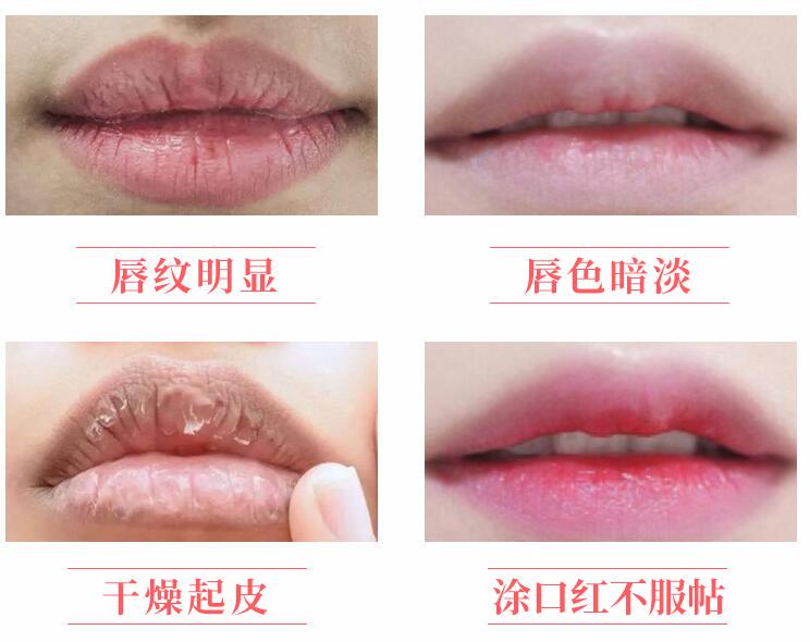 嘴唇干裂开口好疼怎么办，唇部干掉皮护唇方法 嘴唇 嘴唇干裂 嘴唇干裂开口好疼怎么办 美容 第1张