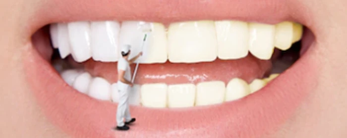 怎样让牙齿变白 让牙齿变白 美妆 第3张