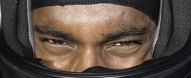 皮肤发黄是什么原因 皮肤发黄 美妆 第3张