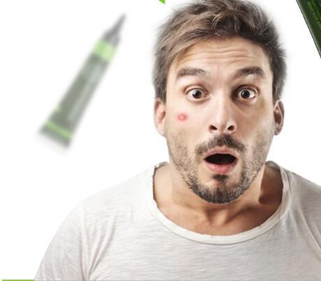 「青春痘」把我们逗的很伤心，有关青春痘的注意事项 青春痘 青春痘的注意事项 美容 第1张