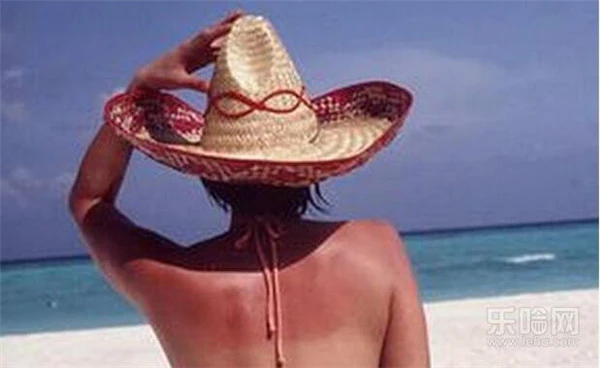 晒伤了用芦荟胶有用吗,晒伤敷芦荟胶、小黄瓜,使用不当可能适得其反! 护肤 第2张 晒伤了用芦荟胶有用吗,晒伤敷芦荟胶、小黄瓜,使用不当可能适得其反! 护肤 第2张