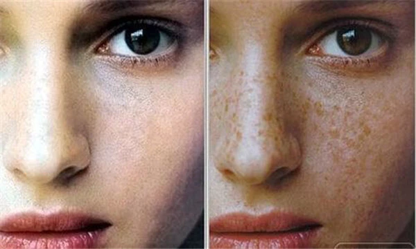 为什么女人会长黄褐斑 护肤 第5张 为什么女人会长黄褐斑 护肤 第5张